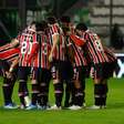 Veja quanto o São Paulo deixo de ganhar com eliminação na Copa do Brasil