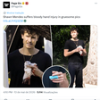 Mão machucada? Shawn Mendes explica acidente doméstico