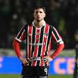 São Paulo perde quantia milionária com eliminação na Copa do Brasil