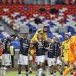 IA faz previsão da Copa do Brasil e coloca Remo diante de rival inesperado