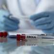 Agência africana de saúde declara epidemia de ebola no leste da República Democrática do Congo