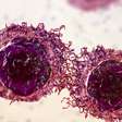 Novo tratamento com pembrolizumabe pode manter pacientes com câncer colorretal livres da doença por anos