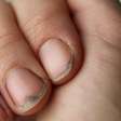 As marcas do tempo nas unhas: como o corpo registra doenças e estresse físico
