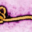 Há risco de o surto de ebola chegar ao Brasil?