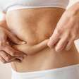 Tecnologia melhora retração da pele após lipoaspiração