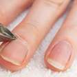 Tirar a cutícula toda semana pode prejudicar suas unhas? Entenda os riscos