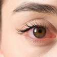 Visão embaçada? Veja como proteger a saúde dos olhos com a alimentação