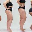 Quem tem lipedema pode correr?