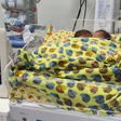 Bebês siameses morrem após quadro infeccioso em Goiás
