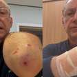 Veja o ferimento em âncora da Globo atacado por pitbull sem focinheira em SP