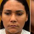 Ex-BBB Chaiany mostra resultado de harmonização facial e web avalia: 'Outra pessoa'
