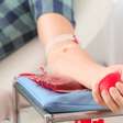 Doar sangue emagrece, enfraquece ou causa anemia? Hematologista esclarece