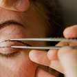 Pálpebras caídas, olhar cansado: quando a blefaroplastia pode fazer sentido?