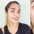 Jéssica Beatriz, filha de Leonardo, exibe novo sorriso após arrumar os dentes quebrados em tombo
