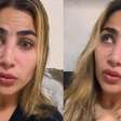Filha de Leonardo explica queda que quebrou dentes e faz alerta: 'Mistura perigosa'