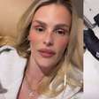 Após sofrer crise de lipedema, Yasmin Brunet alerta sobre alimentação: 'Faz muito mal'