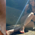 Ana Molina, dermatologista: 'Se você tem tendência a rachaduras nos pés, é melhor usar sandálias com o calcanhar coberto ou, pelo menos, com boa fixação na parte de trás'