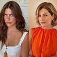Famosas revelam arrependimento com Botox e aquecem debate sobre estética natural