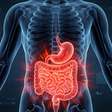 Cirurgia robótica amplia precisão em procedimento digestivo