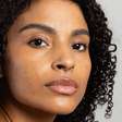 Mês de Conscientização da Acne incentiva cuidados especiais