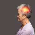 Gene ligado ao Alzheimer pode alterar o cérebro antes da perda de memória