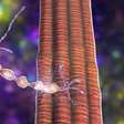 Cientistas holandeses descobrem como células de defesa do cérebro podem acabar agravando a esclerose múltipla