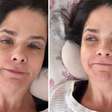SUSTO! Samara Felippo aparece acamada e cheia de curativos: