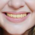 Tem dentes amarelados? Conheça hábitos que escurecem o sorriso