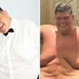 Veja o antes e depois do influenciador Gordão da XJ após perder 130 kg; veja fotos