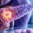 Novas pesquisas, Inteligência Artificial e medicamentos inovadores avançam contra o câncer