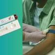 PSA alto nem sempre é câncer: veja o que o exame de sangue para próstata realmente mostra