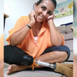 Sobreviveu a um trem, a uma picada de cobra e a mais de 30 cirurgias; agora, Fabiana faz vakinha para continuar andando