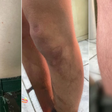 Exército instaura inquérito para investigar agressão contra soldado em quartel de Sant'Ana do Livramento