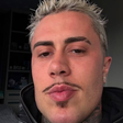MC Daniel faz harmonização facial e resultado ganha repercussão