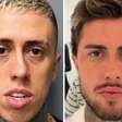 Além de MC Daniel, outros homens famosos que fizeram harmonização; veja os antes e depois