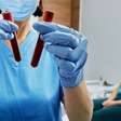Jejum para exame de sangue: por que nem sempre são 8 ou 12 horas?