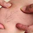 Saúde vascular: cuidados essenciais para quem passou dos 40