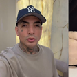 MC Guimê mostra resultado de manutenção da harmonização facial; veja o antes e depois