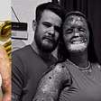 LUTO! Influenciadora morre aos 31 anos após batalha contra doença rara