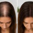 Seu cabelo parece não crescer? Veja o que realmente faz diferença