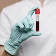 O que significa sonhar com sangue? Descubra os diferentes significados