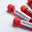 Hepatites virais: veja os sinais do corpo e como prevenir a doença silenciosa