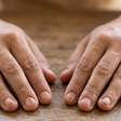 Síndrome da unha-patela: unhas pequenas ou deformadas podem indicar doença rara