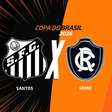Santos x Remo: onde assistir, escalações e arbitragem