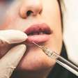 Bioestimulador x Preenchimento: qual a diferença e como escolher?