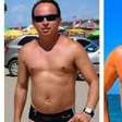 Marido de Gretchen impressiona com antes e depois após procedimentos estéticos
