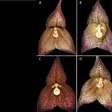 Nova espécie de orquídea Dracula é descoberta no Equador