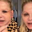Monique Evans revela problema com reconhecimento facial de banco após cirurgia no rosto