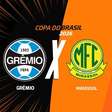Grêmio x Mirassol: onde assistir, escalações e arbitragem