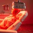 Peeling, laser e mais: agosto é o melhor mês do ano para fazer tratamentos estéticos